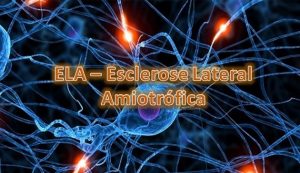 esclerose lateral amiotrófica